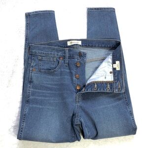 Madewell 10” High-Rise Button Front Skinny Jeans